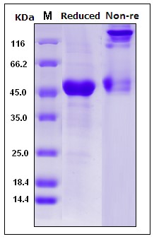 Fig 1. SDS-PAGE analysis of purified Human Il1B